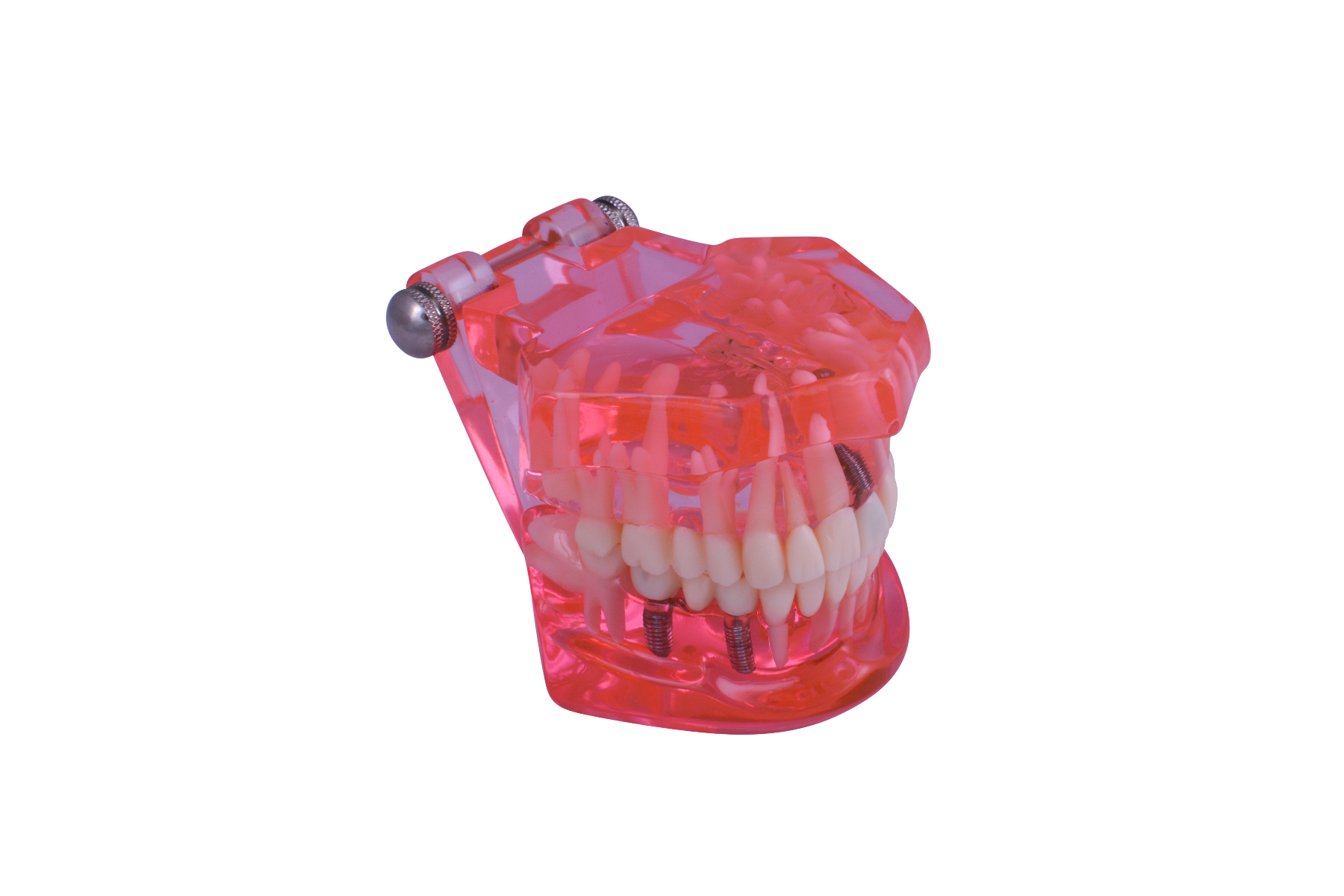 Dental Teaching Model for Patient Education