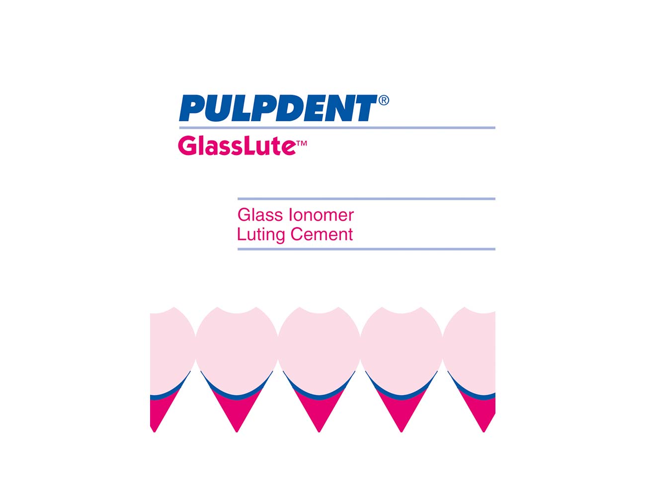 GlassLute kit