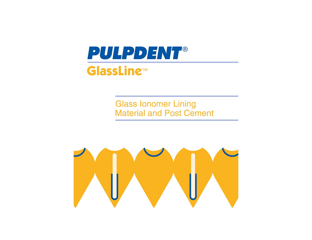 GlassLine Kit